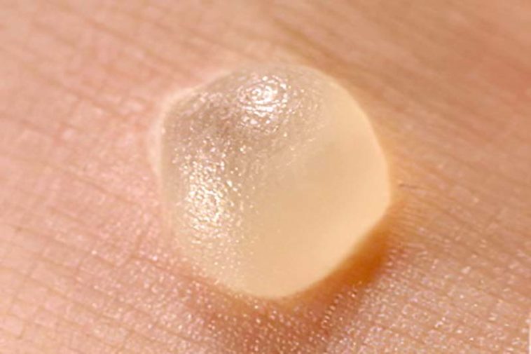 Bonne question Doiton percer des ampoules ou pas ? Astucesbox